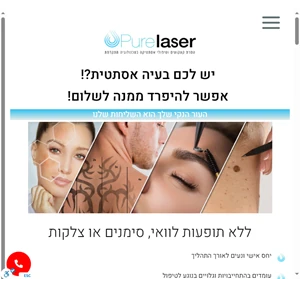 pure laser - הרשת המומלצת ביותר להסרת קעקועים בלייזר