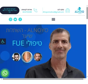 alonyo mediacl קליניקה מתקדמת להשתלות שיער ד"ר אייל עוז