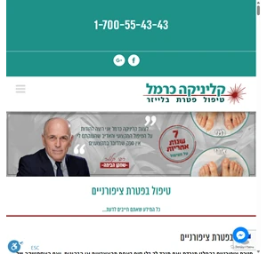 קליניקה כרמל - טיפול בפטרת ציפורניים בלייזר אחריות 7 שנים